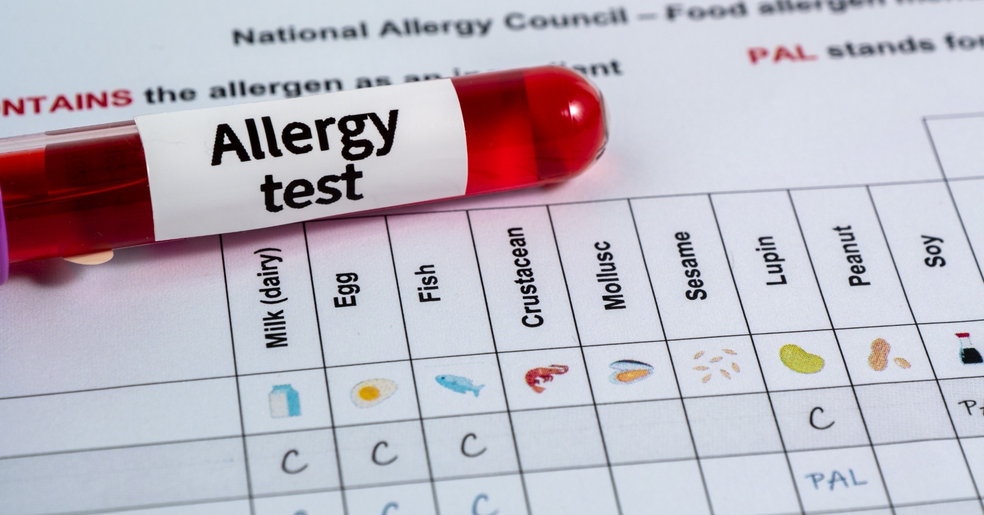 Alergia i nietolerancja pokarmowa - wybrane aspekty praktyczne diagnostyki i leczenia