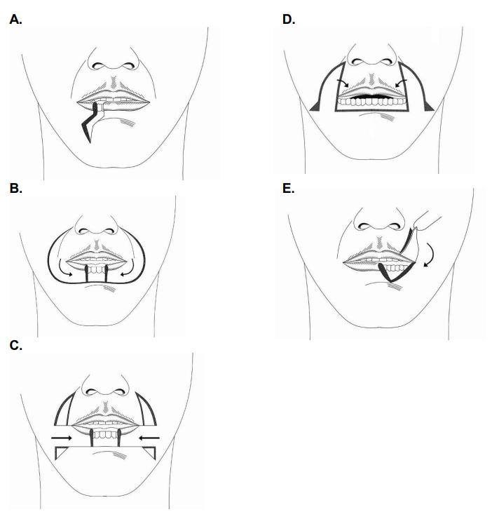 infographic