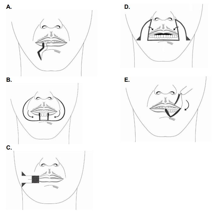 infographic