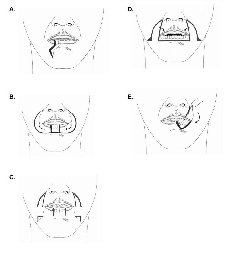 infographic