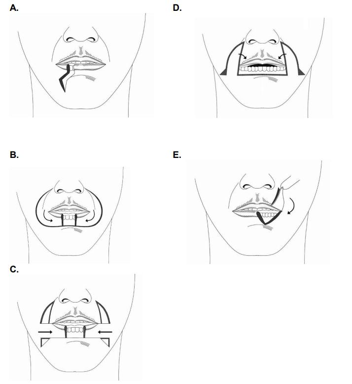 infographic