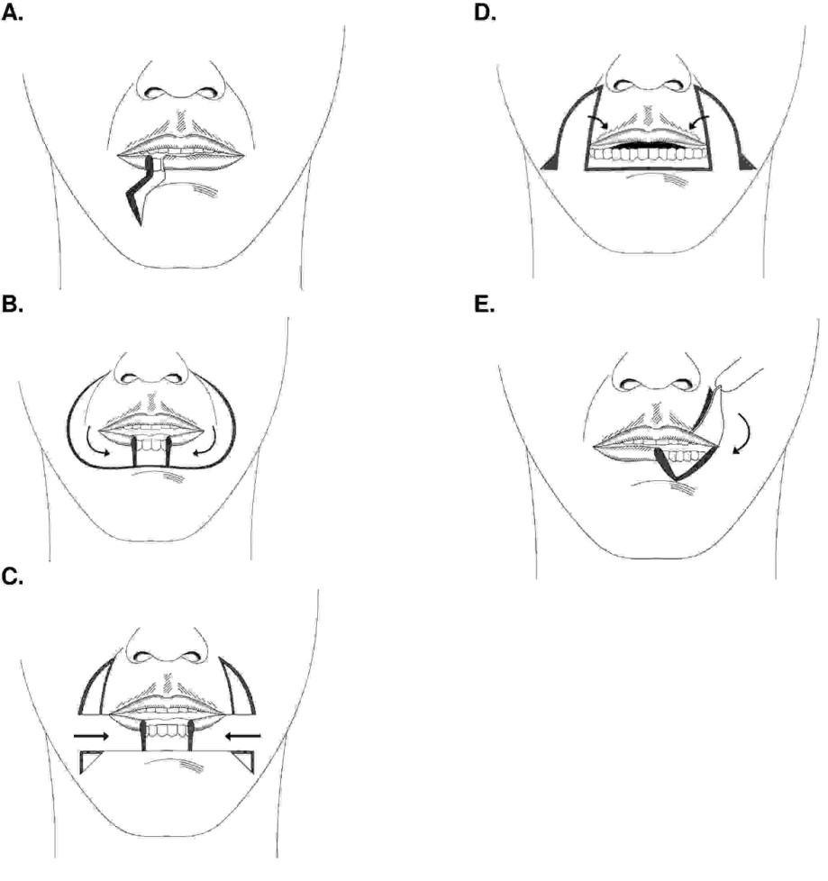 infographic