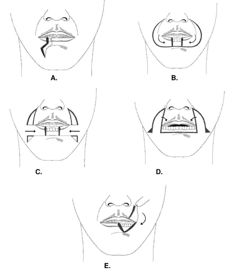 infographic