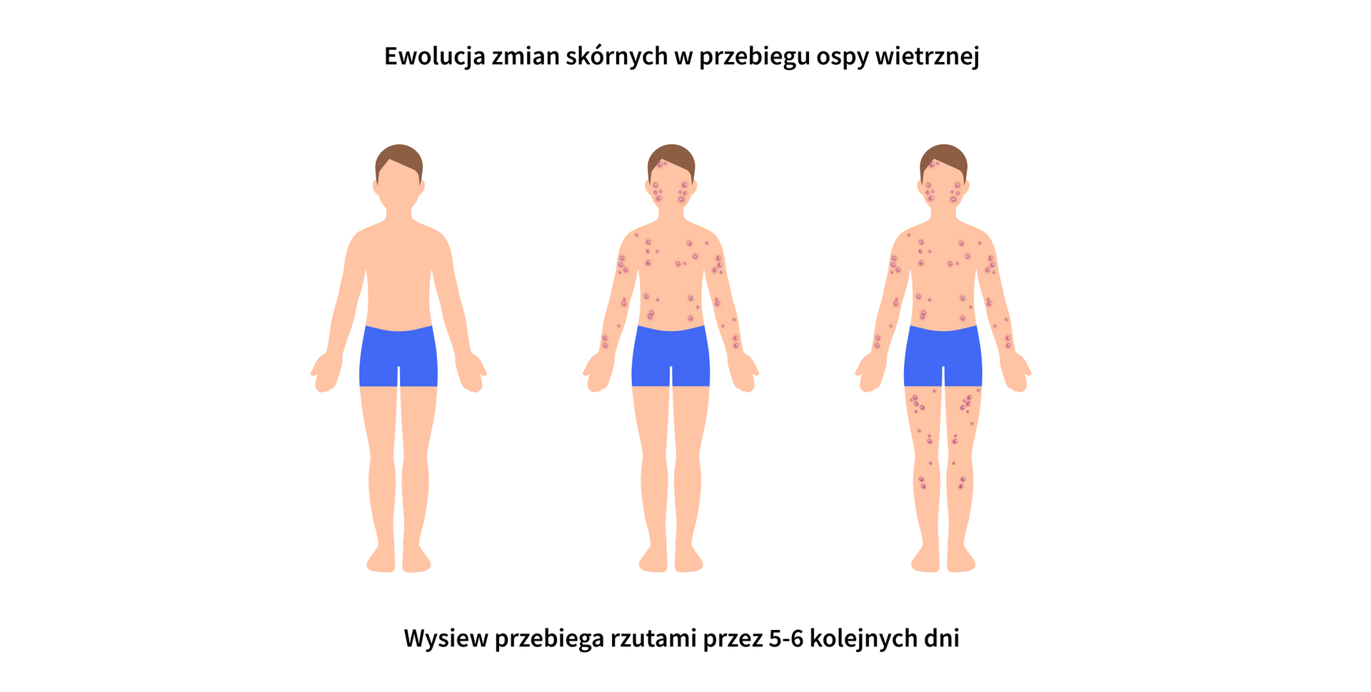 infografika 3