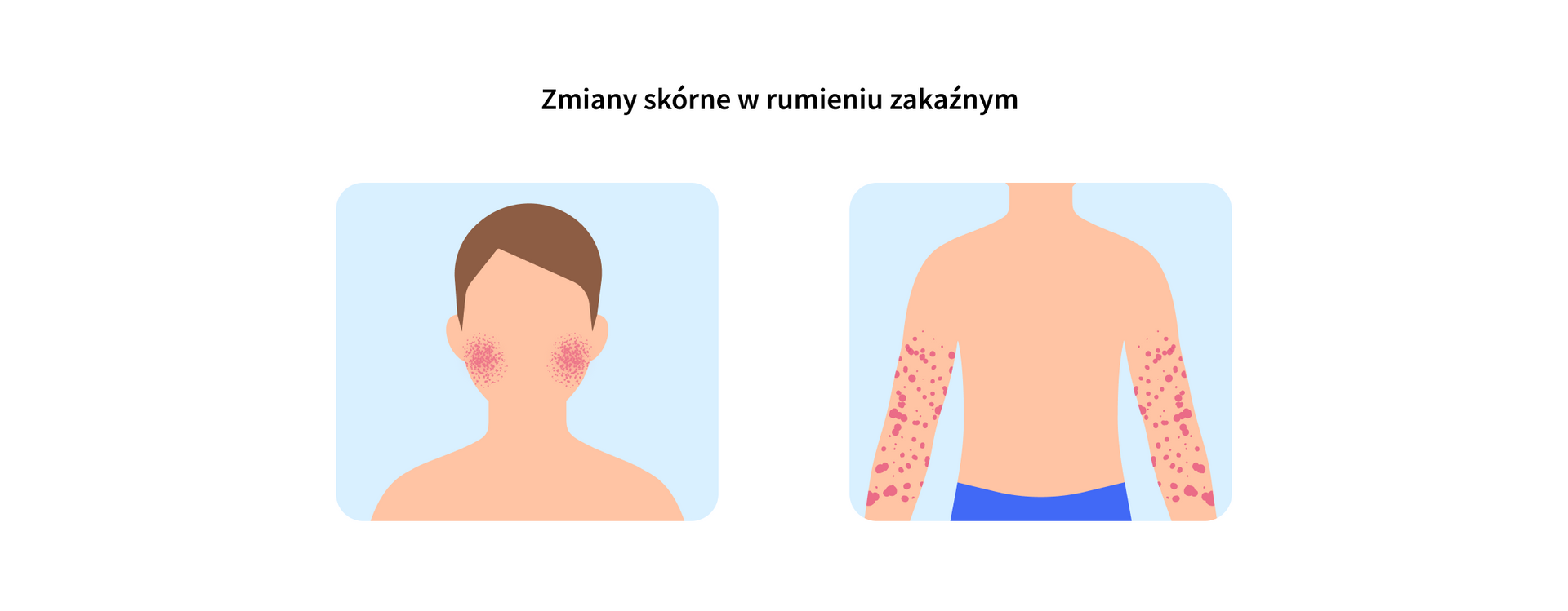 infografika 6