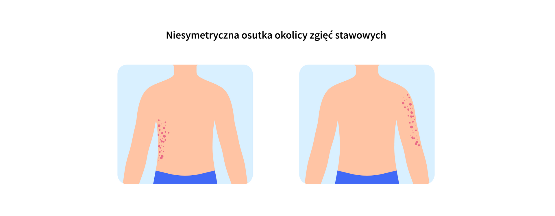 infografika