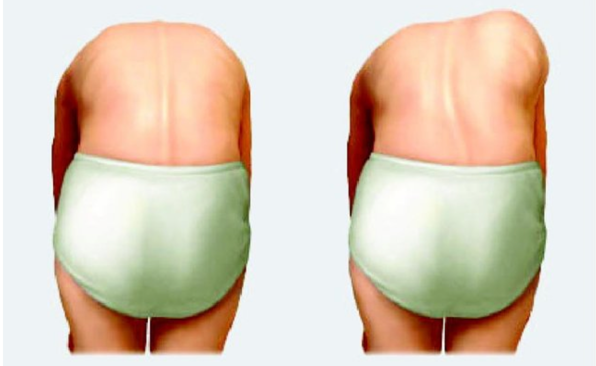 <em>źródło zdjęcia: doi.org/</em><a style="border-color: hsl(var(--border)); border-image-source: none; --tw-border-spacing-x: 0; --tw-border-spacing-y: 0; --tw-translate-x: 0; --tw-translate-y: 0; --tw-rotate: 0; --tw-skew-x: 0; --tw-skew-y: 0; --tw-scale-x: 1; --tw-scale-y: 1; --tw-pan-x: ; --tw-pan-y: ; --tw-pinch-zoom: ; --tw-scroll-snap-strictness: proximity; --tw-gradient-from-position: ; --tw-gradient-via-position: ; --tw-gradient-to-position: ; --tw-ordinal: ; --tw-slashed-zero: ; --tw-numeric-figure: ; --tw-numeric-spacing: ; --tw-numeric-fraction: ; --tw-ring-inset: ; --tw-ring-offset-width: 0px; --tw-ring-offset-color: #fff; --tw-ring-color: rgba(59,130,246,0.5); --tw-ring-offset-shadow: 0 0 #0000; --tw-ring-shadow: 0 0 #0000; --tw-shadow: 0 0 #0000; --tw-shadow-colored: 0 0 #0000; --tw-blur: ; --tw-brightness: ; --tw-contrast: ; --tw-grayscale: ; --tw-hue-rotate: ; --tw-invert: ; --tw-saturate: ; --tw-sepia: ; --tw-drop-shadow: ; --tw-backdrop-blur: ; --tw-backdrop-brightness: ; --tw-backdrop-contrast: ; --tw-backdrop-grayscale: ; --tw-backdrop-hue-rotate: ; --tw-backdrop-invert: ; --tw-backdrop-opacity: ; --tw-backdrop-saturate: ; --tw-backdrop-sepia: ; outline-color: currentcolor; outline-style: none; text-decoration-style: solid; text-decoration-color: currentcolor;" href="https://doi.org/10.1136/bmj.f2508?urlappend=%3Futm_source%3Dresearchgate.net%26medium%3Darticle"><span style="border-color: hsl(var(--border)); border-image-source: none; --tw-border-spacing-x: 0; --tw-border-spacing-y: 0; --tw-translate-x: 0; --tw-translate-y: 0; --tw-rotate: 0; --tw-skew-x: 0; --tw-skew-y: 0; --tw-scale-x: 1; --tw-scale-y: 1; --tw-pan-x: ; --tw-pan-y: ; --tw-pinch-zoom: ; --tw-scroll-snap-strictness: proximity; --tw-gradient-from-position: ; --tw-gradient-via-position: ; --tw-gradient-to-position: ; --tw-ordinal: ; --tw-slashed-zero: ; --tw-numeric-figure: ; --tw-numeric-spacing: ; --tw-numeric-fraction: ; --tw-ring-inset: ; --tw-ring-offset-width: 0px; --tw-ring-offset-color: #fff; --tw-ring-color: rgba(59,130,246,0.5); --tw-ring-offset-shadow: 0 0 #0000; --tw-ring-shadow: 0 0 #0000; --tw-shadow: 0 0 #0000; --tw-shadow-colored: 0 0 #0000; --tw-blur: ; --tw-brightness: ; --tw-contrast: ; --tw-grayscale: ; --tw-hue-rotate: ; --tw-invert: ; --tw-saturate: ; --tw-sepia: ; --tw-drop-shadow: ; --tw-backdrop-blur: ; --tw-backdrop-brightness: ; --tw-backdrop-contrast: ; --tw-backdrop-grayscale: ; --tw-backdrop-hue-rotate: ; --tw-backdrop-invert: ; --tw-backdrop-opacity: ; --tw-backdrop-saturate: ; --tw-backdrop-sepia: ; outline-color: currentcolor; outline-style: none; font-size: 11pt; font-family: Arial, sans-serif; color: rgb(17, 85, 204); font-style: italic; font-variant-ligatures: normal; font-variant-alternates: normal; font-variant-numeric: normal; font-variant-east-asian: normal; font-variant-position: normal; text-decoration-skip-ink: none; vertical-align: baseline; white-space: pre-wrap;"></span><em style="border-color: hsl(var(--border)); border-image-source: none; --tw-border-spacing-x: 0; --tw-border-spacing-y: 0; --tw-translate-x: 0; --tw-translate-y: 0; --tw-rotate: 0; --tw-skew-x: 0; --tw-skew-y: 0; --tw-scale-x: 1; --tw-scale-y: 1; --tw-pan-x: ; --tw-pan-y: ; --tw-pinch-zoom: ; --tw-scroll-snap-strictness: proximity; --tw-gradient-from-position: ; --tw-gradient-via-position: ; --tw-gradient-to-position: ; --tw-ordinal: ; --tw-slashed-zero: ; --tw-numeric-figure: ; --tw-numeric-spacing: ; --tw-numeric-fraction: ; --tw-ring-inset: ; --tw-ring-offset-width: 0px; --tw-ring-offset-color: #fff; --tw-ring-color: rgba(59,130,246,0.5); --tw-ring-offset-shadow: 0 0 #0000; --tw-ring-shadow: 0 0 #0000; --tw-shadow: 0 0 #0000; --tw-shadow-colored: 0 0 #0000; --tw-blur: ; --tw-brightness: ; --tw-contrast: ; --tw-grayscale: ; --tw-hue-rotate: ; --tw-invert: ; --tw-saturate: ; --tw-sepia: ; --tw-drop-shadow: ; --tw-backdrop-blur: ; --tw-backdrop-brightness: ; --tw-backdrop-contrast: ; --tw-backdrop-grayscale: ; --tw-backdrop-hue-rotate: ; --tw-backdrop-invert: ; --tw-backdrop-opacity: ; --tw-backdrop-saturate: ; --tw-backdrop-sepia: ; outline-color: currentcolor; outline-style: none;"></em><em></em><em>10.1136/bmj.f2508</em></a>