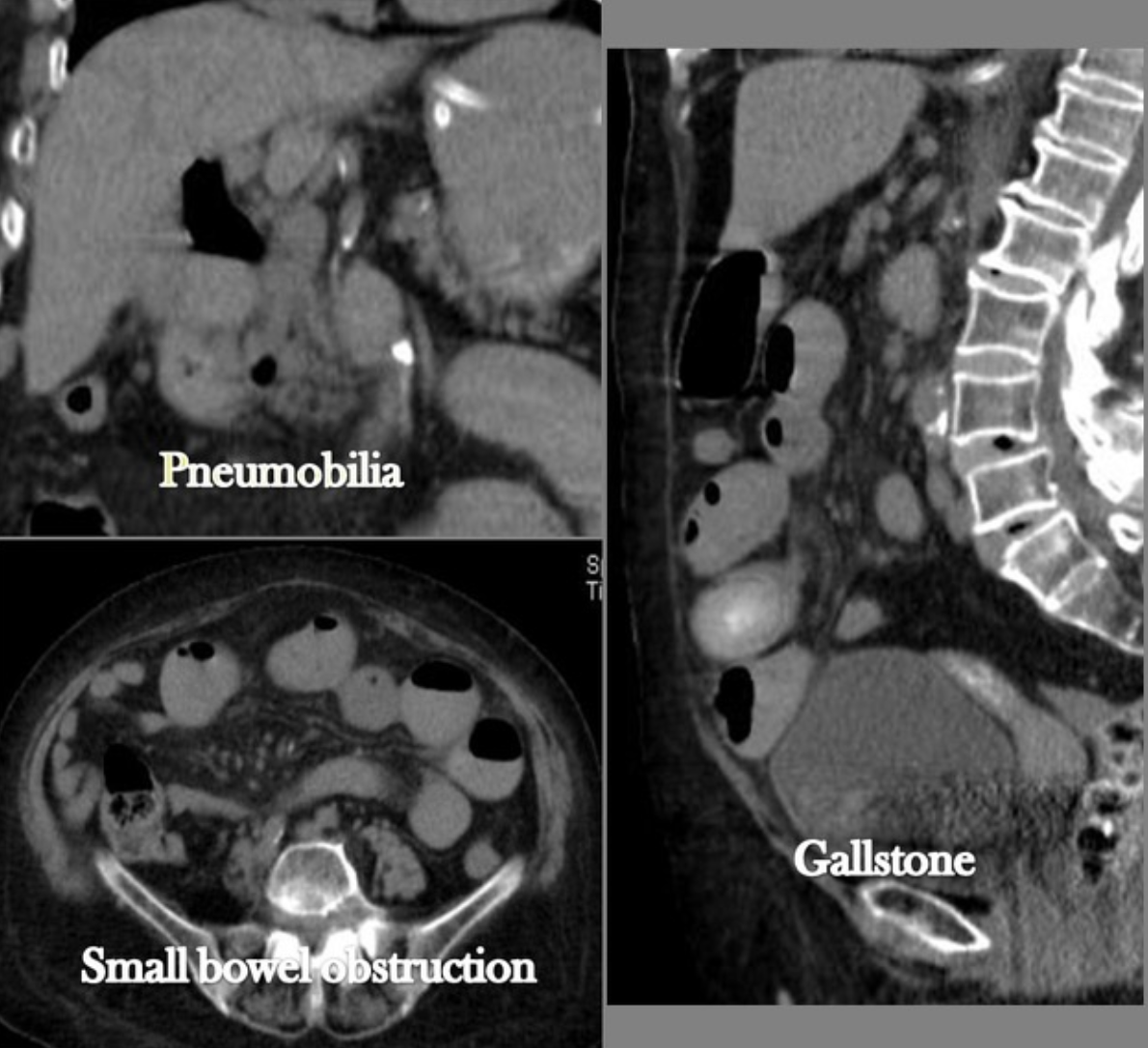 <em>źródło zdjęcia: </em><a style="border-color: hsl(var(--border)); border-image-source: none; --tw-border-spacing-x: 0; --tw-border-spacing-y: 0; --tw-translate-x: 0; --tw-translate-y: 0; --tw-rotate: 0; --tw-skew-x: 0; --tw-skew-y: 0; --tw-scale-x: 1; --tw-scale-y: 1; --tw-pan-x: ; --tw-pan-y: ; --tw-pinch-zoom: ; --tw-scroll-snap-strictness: proximity; --tw-gradient-from-position: ; --tw-gradient-via-position: ; --tw-gradient-to-position: ; --tw-ordinal: ; --tw-slashed-zero: ; --tw-numeric-figure: ; --tw-numeric-spacing: ; --tw-numeric-fraction: ; --tw-ring-inset: ; --tw-ring-offset-width: 0px; --tw-ring-offset-color: #fff; --tw-ring-color: rgba(59,130,246,0.5); --tw-ring-offset-shadow: 0 0 #0000; --tw-ring-shadow: 0 0 #0000; --tw-shadow: 0 0 #0000; --tw-shadow-colored: 0 0 #0000; --tw-blur: ; --tw-brightness: ; --tw-contrast: ; --tw-grayscale: ; --tw-hue-rotate: ; --tw-invert: ; --tw-saturate: ; --tw-sepia: ; --tw-drop-shadow: ; --tw-backdrop-blur: ; --tw-backdrop-brightness: ; --tw-backdrop-contrast: ; --tw-backdrop-grayscale: ; --tw-backdrop-hue-rotate: ; --tw-backdrop-invert: ; --tw-backdrop-opacity: ; --tw-backdrop-saturate: ; --tw-backdrop-sepia: ; outline-color: currentcolor; outline-style: none; text-decoration-style: solid; text-decoration-color: currentcolor;" href="https://doi.org/10.53347/rID-6905"><span style="border-color: hsl(var(--border)); border-image-source: none; --tw-border-spacing-x: 0; --tw-border-spacing-y: 0; --tw-translate-x: 0; --tw-translate-y: 0; --tw-rotate: 0; --tw-skew-x: 0; --tw-skew-y: 0; --tw-scale-x: 1; --tw-scale-y: 1; --tw-pan-x: ; --tw-pan-y: ; --tw-pinch-zoom: ; --tw-scroll-snap-strictness: proximity; --tw-gradient-from-position: ; --tw-gradient-via-position: ; --tw-gradient-to-position: ; --tw-ordinal: ; --tw-slashed-zero: ; --tw-numeric-figure: ; --tw-numeric-spacing: ; --tw-numeric-fraction: ; --tw-ring-inset: ; --tw-ring-offset-width: 0px; --tw-ring-offset-color: #fff; --tw-ring-color: rgba(59,130,246,0.5); --tw-ring-offset-shadow: 0 0 #0000; --tw-ring-shadow: 0 0 #0000; --tw-shadow: 0 0 #0000; --tw-shadow-colored: 0 0 #0000; --tw-blur: ; --tw-brightness: ; --tw-contrast: ; --tw-grayscale: ; --tw-hue-rotate: ; --tw-invert: ; --tw-saturate: ; --tw-sepia: ; --tw-drop-shadow: ; --tw-backdrop-blur: ; --tw-backdrop-brightness: ; --tw-backdrop-contrast: ; --tw-backdrop-grayscale: ; --tw-backdrop-hue-rotate: ; --tw-backdrop-invert: ; --tw-backdrop-opacity: ; --tw-backdrop-saturate: ; --tw-backdrop-sepia: ; outline-color: currentcolor; outline-style: none; font-size: 11pt; font-family: Arial, sans-serif; color: rgb(17, 85, 204); font-style: italic; font-variant-ligatures: normal; font-variant-alternates: normal; font-variant-numeric: normal; font-variant-east-asian: normal; font-variant-position: normal; text-decoration-skip-ink: none; vertical-align: baseline; white-space: pre-wrap;"></span><em style="border-color: hsl(var(--border)); border-image-source: none; --tw-border-spacing-x: 0; --tw-border-spacing-y: 0; --tw-translate-x: 0; --tw-translate-y: 0; --tw-rotate: 0; --tw-skew-x: 0; --tw-skew-y: 0; --tw-scale-x: 1; --tw-scale-y: 1; --tw-pan-x: ; --tw-pan-y: ; --tw-pinch-zoom: ; --tw-scroll-snap-strictness: proximity; --tw-gradient-from-position: ; --tw-gradient-via-position: ; --tw-gradient-to-position: ; --tw-ordinal: ; --tw-slashed-zero: ; --tw-numeric-figure: ; --tw-numeric-spacing: ; --tw-numeric-fraction: ; --tw-ring-inset: ; --tw-ring-offset-width: 0px; --tw-ring-offset-color: #fff; --tw-ring-color: rgba(59,130,246,0.5); --tw-ring-offset-shadow: 0 0 #0000; --tw-ring-shadow: 0 0 #0000; --tw-shadow: 0 0 #0000; --tw-shadow-colored: 0 0 #0000; --tw-blur: ; --tw-brightness: ; --tw-contrast: ; --tw-grayscale: ; --tw-hue-rotate: ; --tw-invert: ; --tw-saturate: ; --tw-sepia: ; --tw-drop-shadow: ; --tw-backdrop-blur: ; --tw-backdrop-brightness: ; --tw-backdrop-contrast: ; --tw-backdrop-grayscale: ; --tw-backdrop-hue-rotate: ; --tw-backdrop-invert: ; --tw-backdrop-opacity: ; --tw-backdrop-saturate: ; --tw-backdrop-sepia: ; outline-color: currentcolor; outline-style: none;"></em><em></em><em>doi.org/10.53347/rID-6905</em></a>