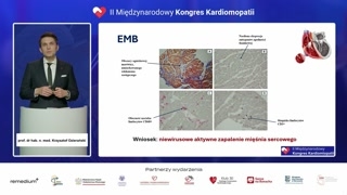 Przypadek kliniczny: ostre zapalenie mięśnia sercowego