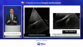 Kazuistyka i echokardiograficzne pułapki