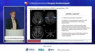Ból i neuropatia w chorobie Fabry'ego