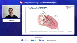 Patofizjologia SAM i wpływ na objawy