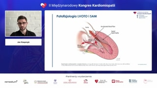 Mechanizmy obturacji i obraz kliniczny
