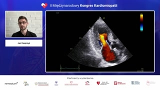 Przykłady echokardiograficzne i wyzwania diagnostyczne