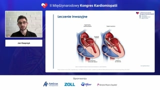Farmakologiczne leczenie kardiomiopatii przerostowej