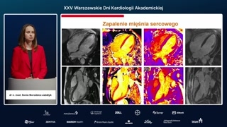 Zapalenie mięśnia sercowego