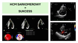 Długoterminowe rokowanie i progresja kardiomiopatii przerostowej