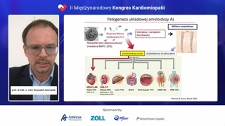 Patogeneza amyloidozy AL i gammapatia monoklonalna