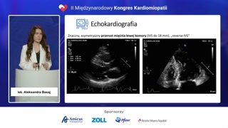 Wyniki badania echokardiograficznego