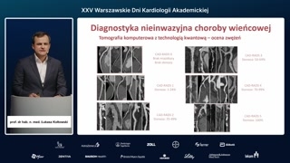 Ocena dokładności CCTA i klasyfikacja CADRADS