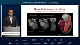 Rozwój technologii tomograficznych: od spiralnej po dual-source