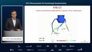 Ocena funkcjonalna FFRct jako one-stop-shop diagnostyczny