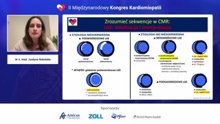 Interpretacja wzorców LGE