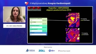 Przypadek 1: Potwierdzenie amyloidozy i charakterystyczne objawy