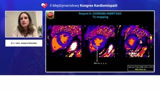 Przypadek 2: Wyniki MRI i diagnoza choroby Fabry'ego