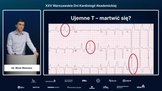 Normalne ujemne załamki T w blokach odnóg