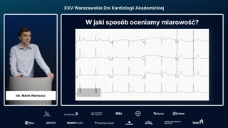 Ocena miarowości i częstości rytmu: metoda kartki
