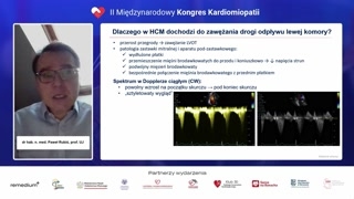 Ocena gradientu w drodze odpływu lewej komory