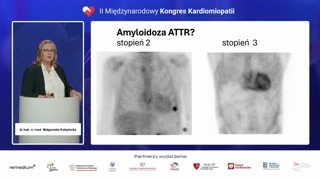 Praktyczne przykłady interpretacji skali Peruginiego
