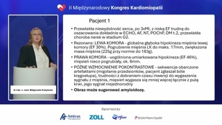 Studium przypadku: Scyntygrafia negatywna