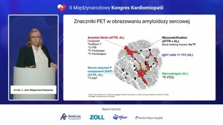 Przyszłość obrazowania amyloidozy: PET