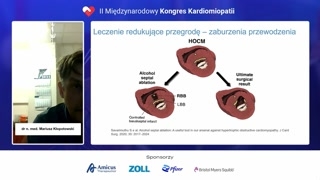 Wpływ zabiegów na EKG i ryzyko wszczepienia stymulatora
