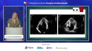 Metody echokardiograficznej oceny gradientów