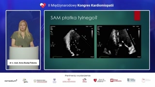 Fenomen SAM zastawki mitralnej