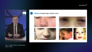 Objawy i wpływ alergicznego nieżytu nosa na jakość życia