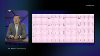 Przypadek 2: Rozpoznawanie błędnie podłączonych elektrod EKG