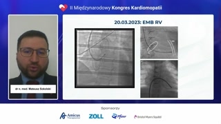 Wizualizacja i strategia pobierania próbek