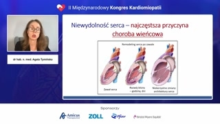Przyczyny niewydolności serca