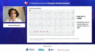 Elektrokardiografia w sarkoidozie serca