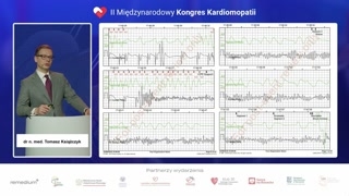 Idiopatyczne migotanie komór i rola AED