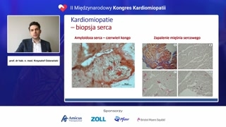 Biopsja serca