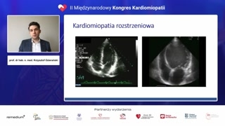Kardiomiopatia rozstrzeniowa