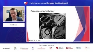 Diagnostyka obrazowa: Echokardiografia i MRI