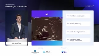 Kryteria audytu FMF: kość nosowa