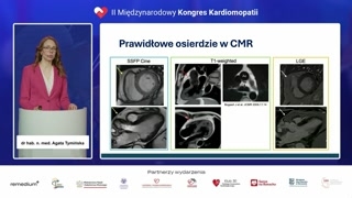 Obrazowanie osierdzia rezonansem magnetycznym