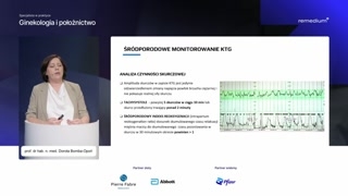 Nowe rekomendacje monitorowania KTG